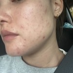 View Gallery Image #1