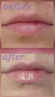 View Gallery Image #11
