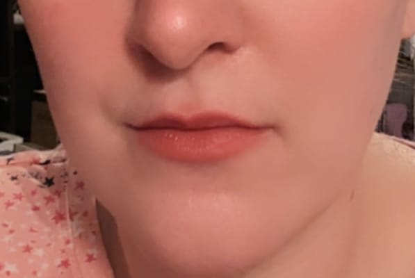 View Gallery Image #3