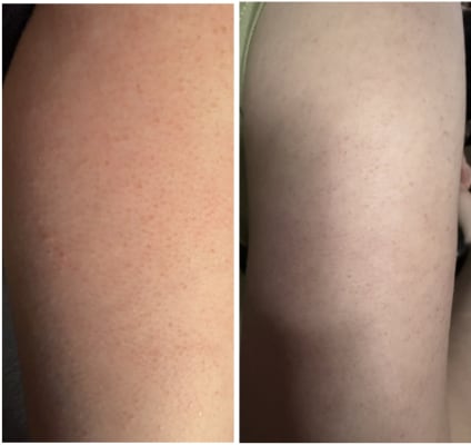 View Gallery Image #16