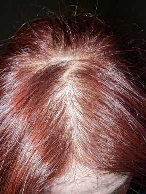 View Gallery Image #1