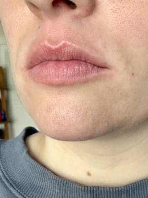 View Gallery Image #1