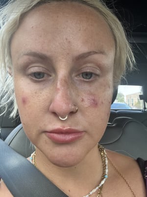 View Gallery Image #2