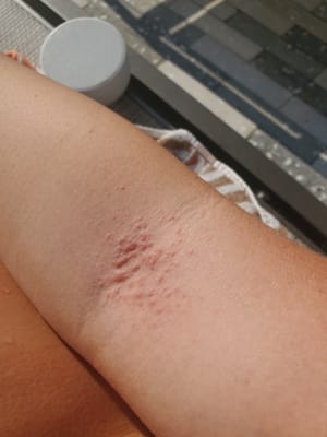 View Gallery Image #1