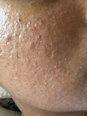 View Gallery Image #1