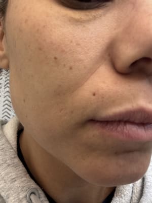 View Gallery Image #1