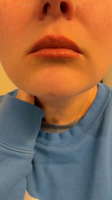 View Gallery Image #1