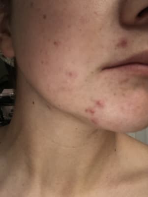 View Gallery Image #2