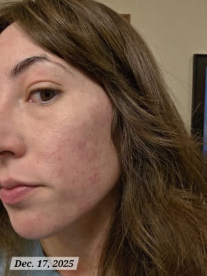 View Gallery Image #1