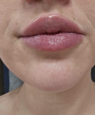 View Gallery Image #11