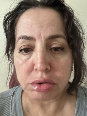 View Gallery Image #1