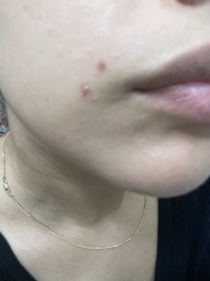 View Gallery Image #1