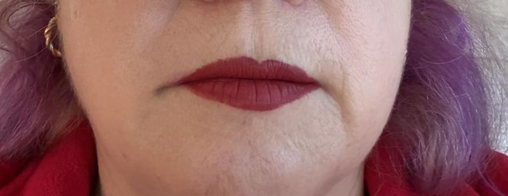 View Gallery Image #2