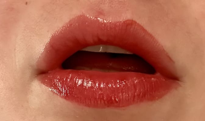 View Gallery Image #1