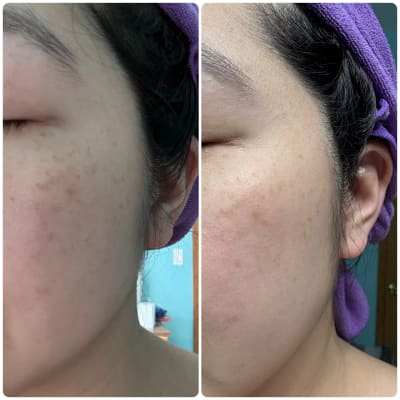 View Gallery Image #1