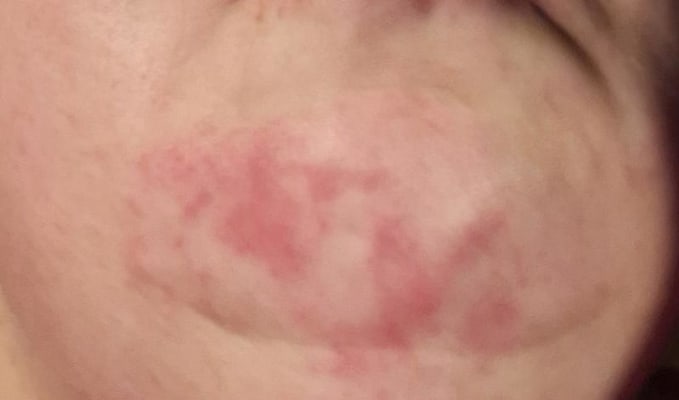 View Gallery Image #1