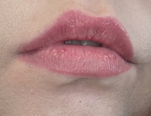 View Gallery Image #1