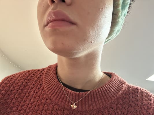 View Gallery Image #1