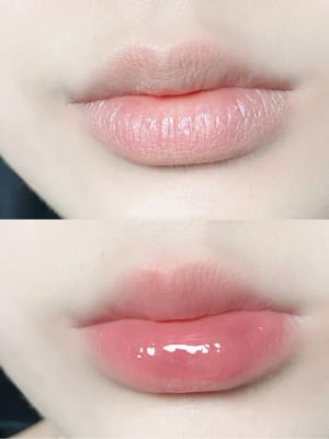 View Gallery Image #1