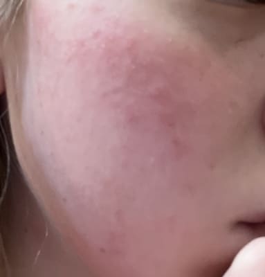 View Gallery Image #1