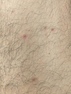 View Gallery Image #6