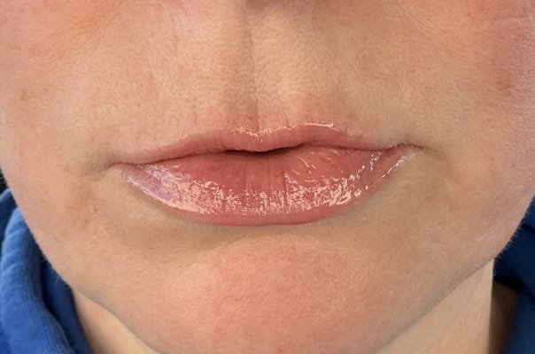 View Gallery Image #1