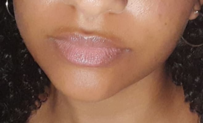 View Gallery Image #1