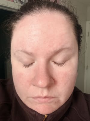 View Gallery Image #1