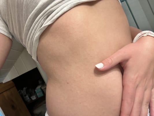 View Gallery Image #1