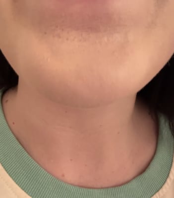 View Gallery Image #1