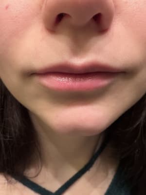 View Gallery Image #1