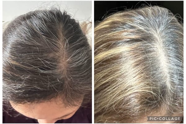 View Gallery Image #1