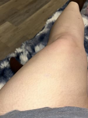 View Gallery Image #1