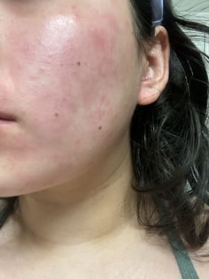 View Gallery Image #1