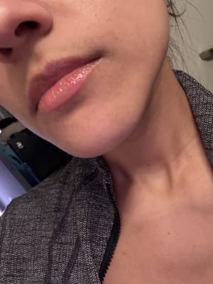 View Gallery Image #1