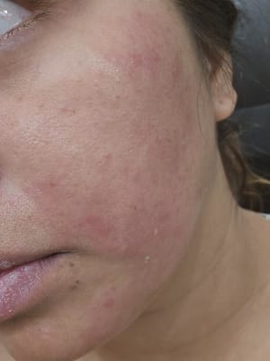 View Gallery Image #2