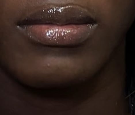View Gallery Image #1