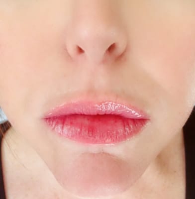 View Gallery Image #1