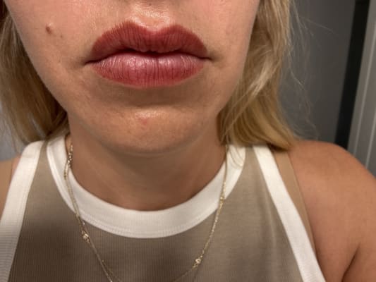 View Gallery Image #1