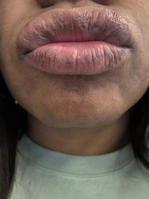 View Gallery Image #1