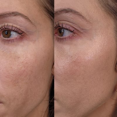 View Gallery Image #11