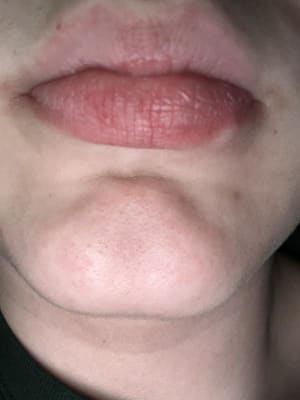 View Gallery Image #1