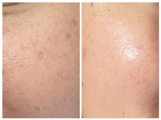 View Gallery Image #3