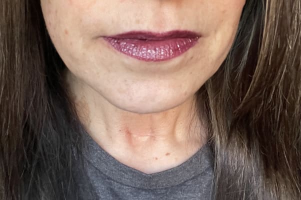 View Gallery Image #12