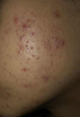 View Gallery Image #1