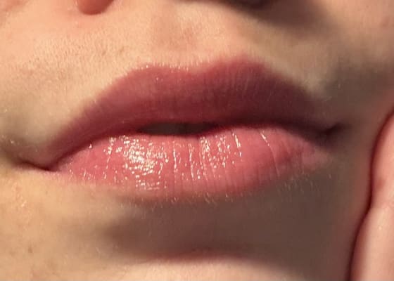 View Gallery Image #1