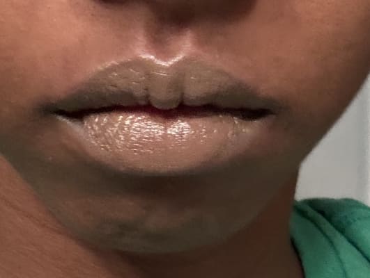 View Gallery Image #1
