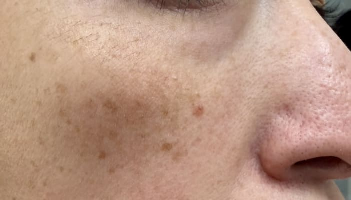 View Gallery Image #10