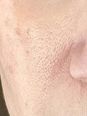 View Gallery Image #1