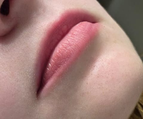 View Gallery Image #1
